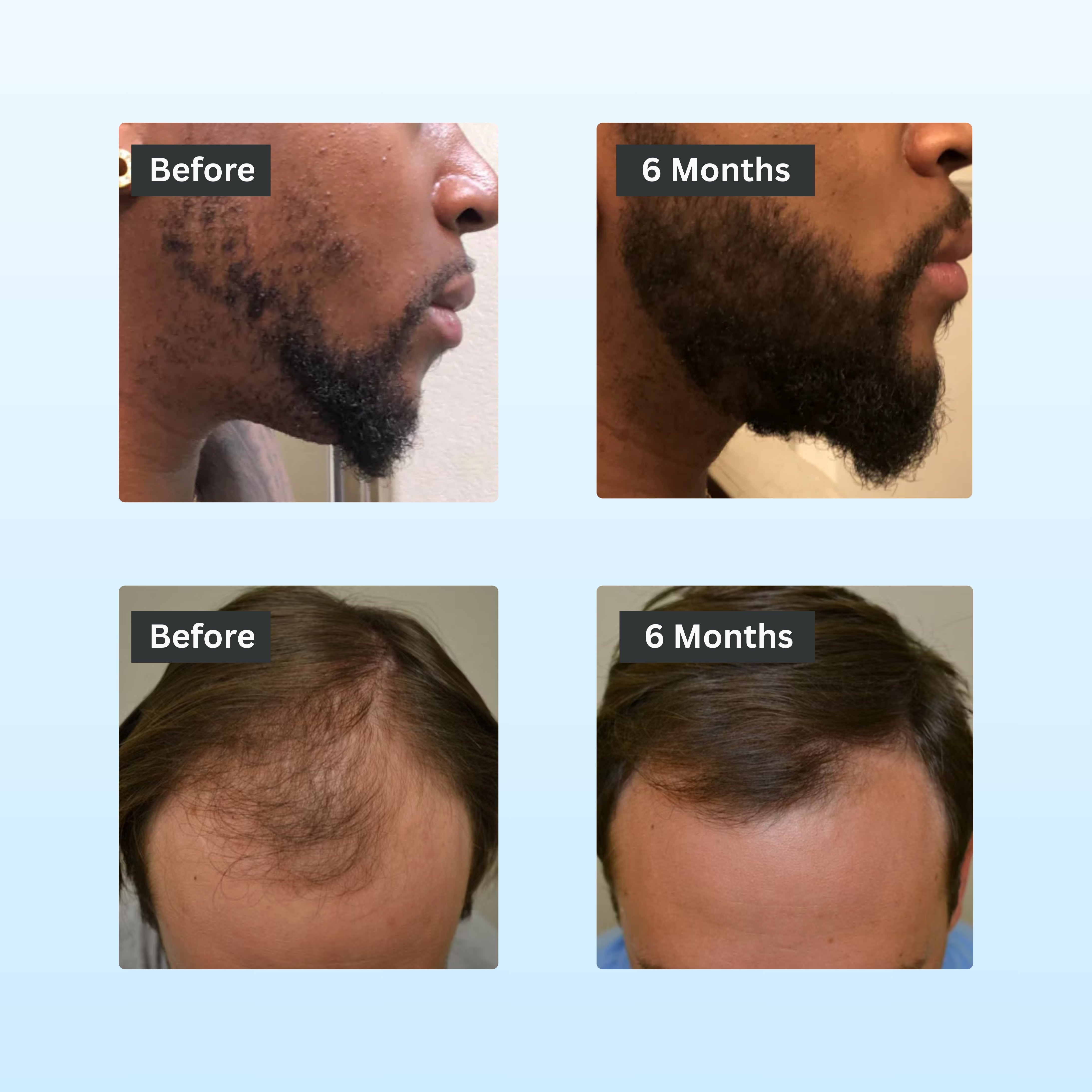 Hair Growth Serum